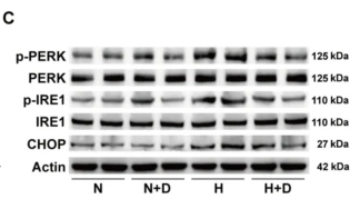 Phospho-PERK (Thr982) Antibody - Fig.