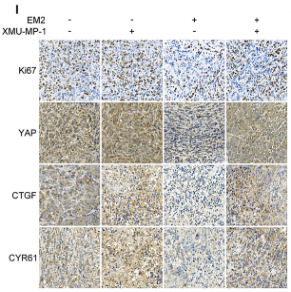 Ki67 Antibody - Figure 7 The role and mechanism of EM2 in inhibiting the tumor growth of NSCLC in vivo.