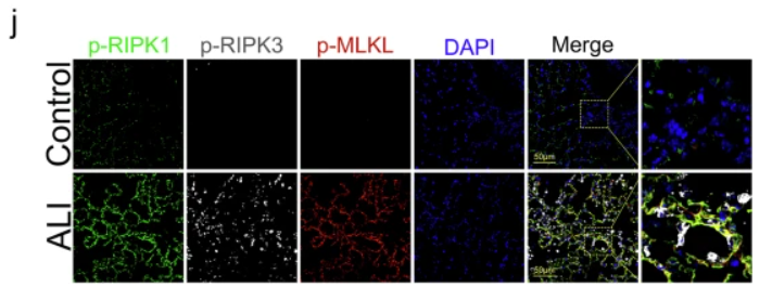 Phospho-RIPK1 (Ser166) Antibody - Fig.