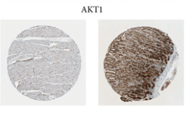 pan-AKT1/2/3 Antibody - Figure 14.