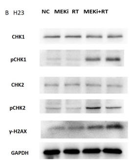 Phospho-Chk2 (Thr68) Antibody - FIGURE 5 MEKi is dependent on CHK2 to inhibit repair of RT-induced DNA damage.