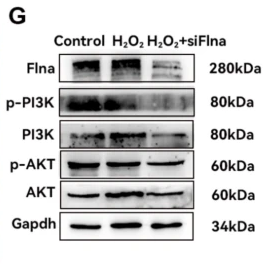 PI3K p85 alpha Antibody - Fig.