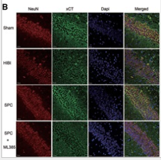xCT Antibody - Figure 3.