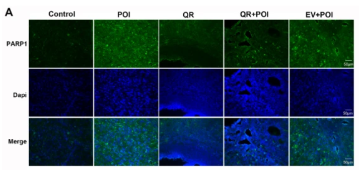PARP1 Antibody - Fig.