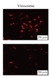 Vimentin Antibody - Fig.