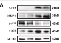 Phospho-p38 MAPK (Thr180/Tyr182) Antibody - Fig.