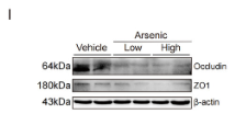 ZO 1 Antibody - Figure 1 Arsenic disrupts the mechanical barrier of intestine in the mice.