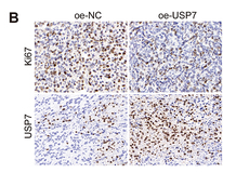 Ki67 Antibody - Figure 8.