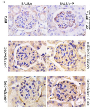 Phospho-IRF3 (Ser396) Antibody - Fig.
