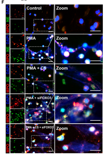 Neutrophil Elastase Antibody - Fig.