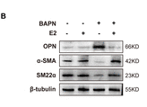 Tubulin beta Antibody - Figure 5.