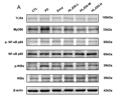 Phospho-IKB alpha (Ser32/Ser36) Antibody - Fig.