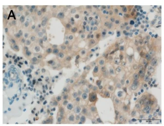 STAT3 Antibody - Fig.