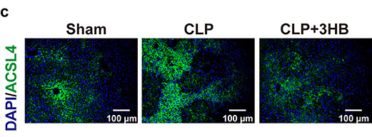 ACSL4/FACL4 Antibody - Figure 6.