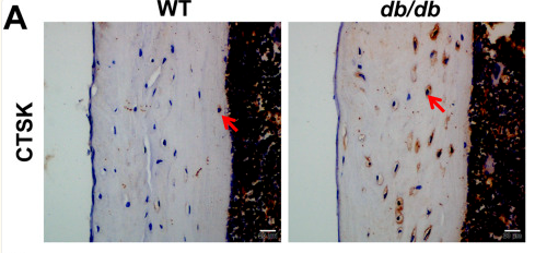 CTSK Antibody - FIGURE 5.