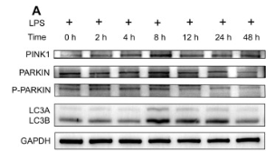 PINK1 Antibody - Fig.