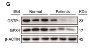 beta-Actin Antibody - Figure 3GSTP1 changes in Ang II-induced atrial fibrillation found by ferroptosis microarray.