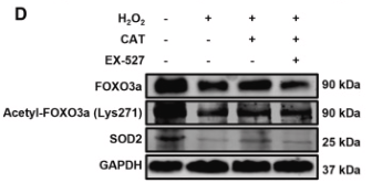 Acetyl-FOXO3A (Lys271) Antibody - Fig.