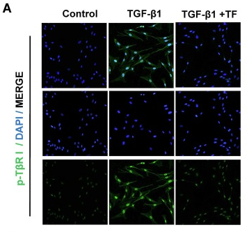 Phospho-TGFBR1 (Thr204) Antibody - Fig.