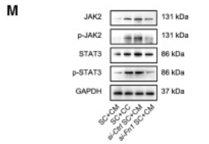Phospho-JAK2 (Tyr931) Antibody - Figure 4 ITGA5-induced NGF secretion in Schwann cells (A) Representative figures of GFAP (red) and p75NTR (green) staining in tumor tissues.