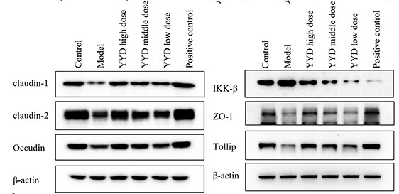 ZO 1 Antibody - Figure 4 Pathological Changes in Mice with Colonic Mucosal Barrier Injury Treated with YYD.