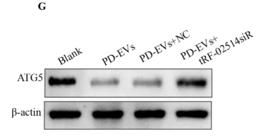 APG5L/ATG5 Antibody - Fig.
