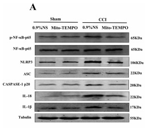 Cleaved-IL-1 beta (Asp116) Antibody - Fig.
