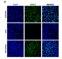 MMP9 Antibody - Figure 3 Effects of tFNAs on DOX-induced fibrosis in vitro.
