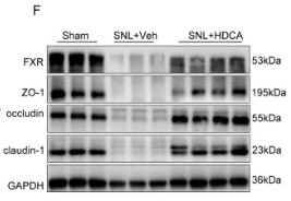 ZO 1 Antibody - Fig.