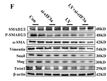 Phospho-Smad2/3 (Thr8) Antibody - Fig.