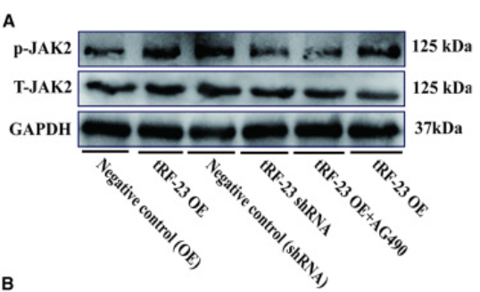 Phospho-JAK2 (Tyr931) Antibody - Figure 5 tRF-23 regulates the osteogenesis of hBMSCs by targeting SOCS1 and regulating JAK2/STAT3 activity (A and B) Overexpressing and knocking down tRF-23 respectively led to higher and lower levels of p-JAK2/STAT3.