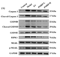 Phospho-MLKL (Ser358) Antibody - Figure 7.