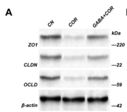 Occludin Antibody - Fig.