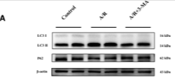 SQSTM1/p62 Antibody - FIGURE 8.