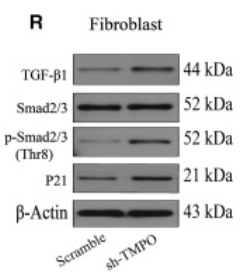 p21 Cip1 Antibody - Figure 9 Mechanism exploration of TMPO (A and B) CCK-8 assay was used to assess the cell viability of HaCaT and fibroblast cells after treatment with Elesclomol+Cu2+ (1 μM) across different concentration gradients (A) and time gradients (B).