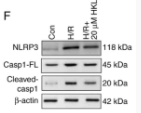 Caspase 1 Antibody - Figure 2 - HKL treatment notably inhibits pyroptosis in IEC-6 cells following H/R.