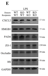 CXCL2 Antibody - FIGURE 3 FKBP5 deficiency in non-haematopoietic cells contributes to attenuation of septic ARDS.