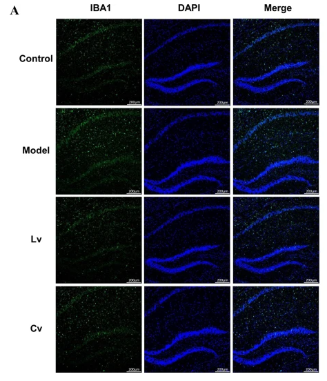 AIF1/IBA1 Antibody - Fig.