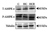 Tubulin alpha Antibody - Figure 3 (A) Benfotiamine alleviates mitophagy disorder in the liver of M.