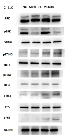 Phospho-IRF3 (Ser396) Antibody - FIGURE 3 Activation of the cGAS-STING pathway proteins by MEKi+RT.
