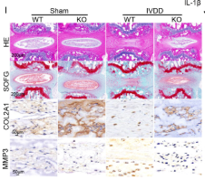 Collagen II Antibody - FIGURE 2 FABP4 played a critical role in mediating obesity-related IVDD.