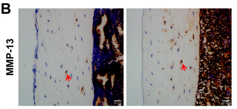 MMP13 Antibody - FIGURE 5.