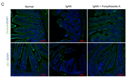 ZO 1 Antibody - FIGURE 3 Forsythiaside A alleviates intestinal barrier injury in IgAN model rats.
