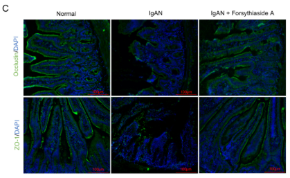 Occludin Antibody - FIGURE 3 Forsythiaside A alleviates intestinal barrier injury in IgAN model rats.