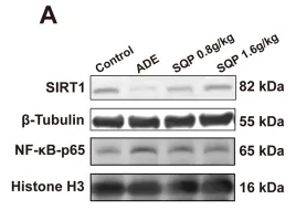 SIRT1 Antibody - FIGURE 8 Impact of SQP on SIRT1/NF-κB pathway in CKD.