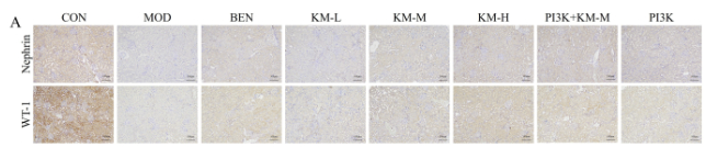 WT1 Antibody - Figure 4: Kemeng Fang alleviates podocyte damage by activating the PI3K/AKT signaling pathway.