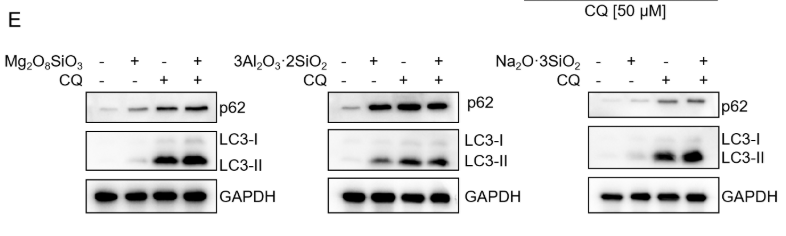 SQSTM1/p62 Antibody - Figure 4.