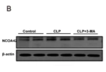 NCOA4 Antibody - Fig.