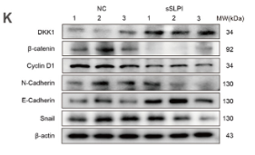 beta Catenin Antibody - Figure 4 SLPI contributes to invasiveness at the tumor margin.
