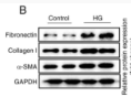 alpha SMA Antibody - Figure 1 - Identification of differentially regulated tRFs in HG-treated renal tubular epithelial cells.